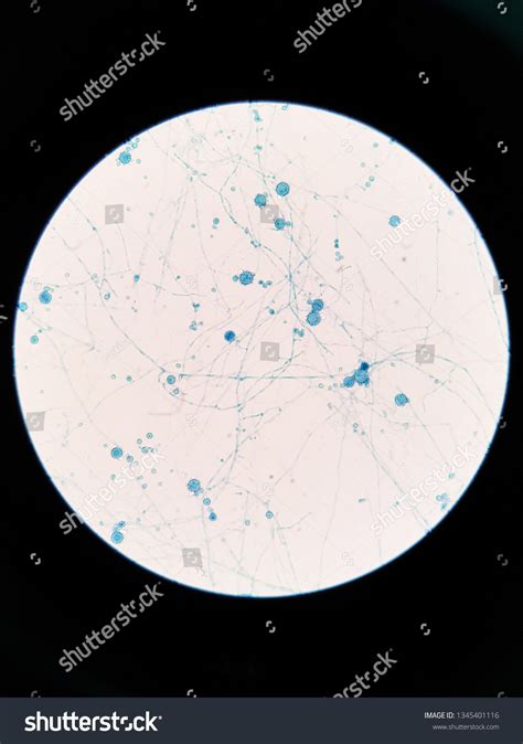 Histoplasma Capsulatum Under Light Microscope Stock Photo 1345401116 ...