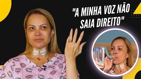 Solange Almeida emociona ao detalhar conseguência na voz por uso de