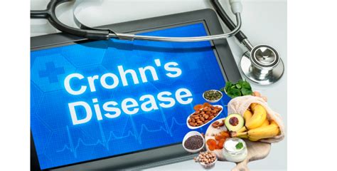 Morbus Crohn Und Ernährung