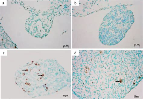 Immunostaining Of Apoptotic Cells In The Presumed Female Gonad Of The