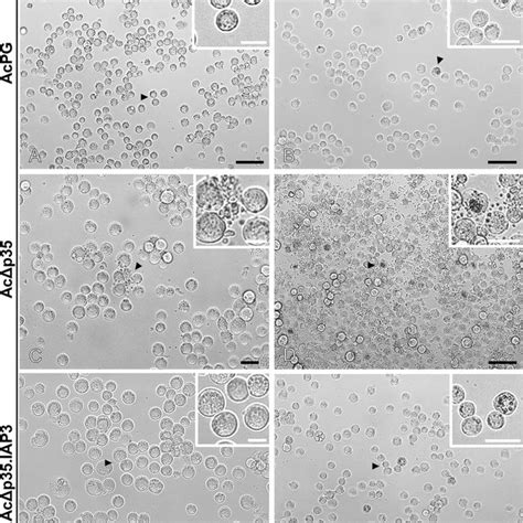 Morphological Analysis With Sf Insect Cells Infected With Different