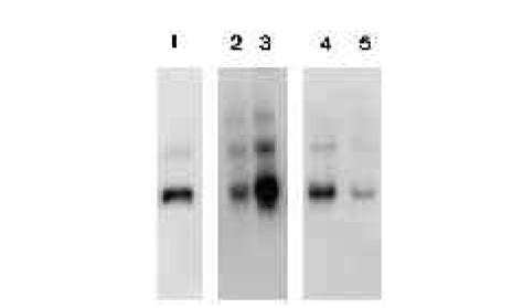 Northern Blot Analysis Of Phox Expression Total Rna G In Lane