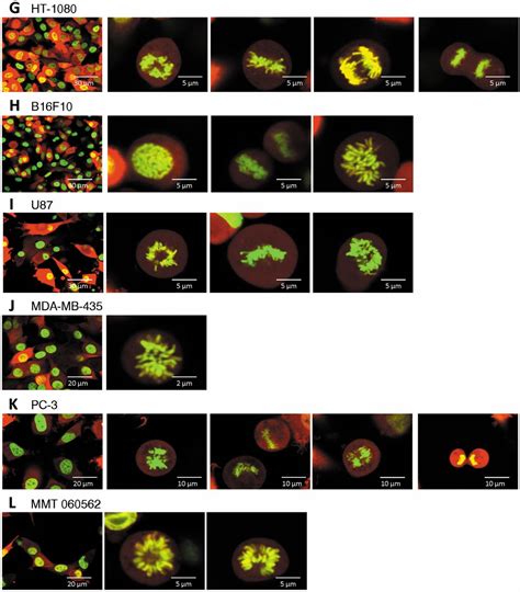 The Use Of Living Cancer Cells Expressing Green Fluorescent Protein In