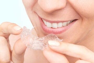 Invisalign Teeth Straightening In Stanbul Turkey Dentist Turkey