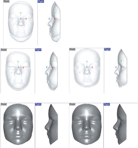 13 Quality Of Outcome Pocket Dentistry