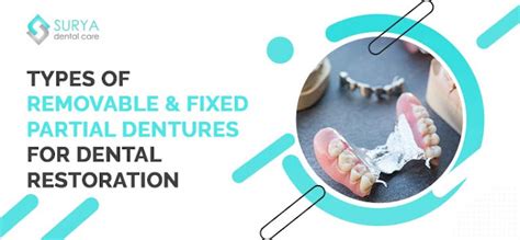 5 different types of partial dentures