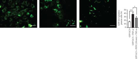 The Increased Autophagy In Htr Svneo Cocultured With Conditioned