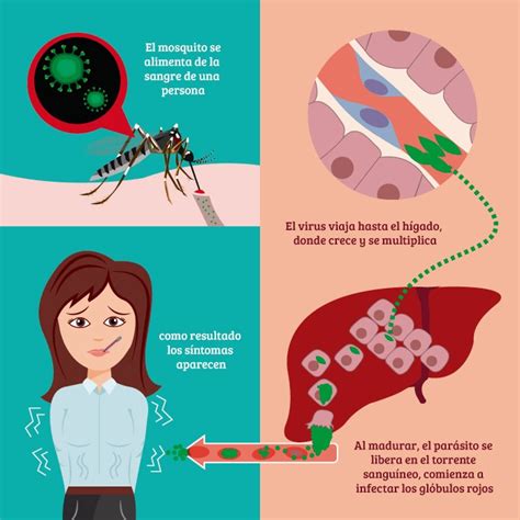 Diagn Stico Diferencial De Malaria Parasitolog A