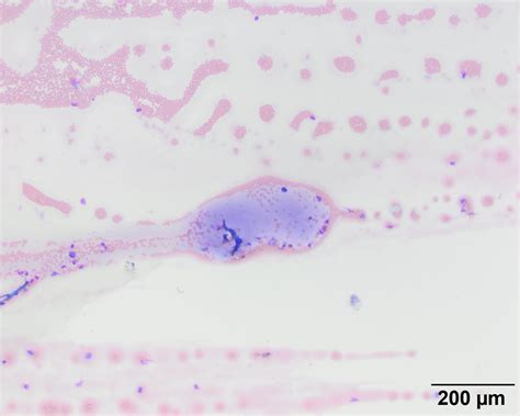 Fibrin Archives Eclinpath