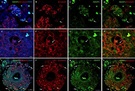 Double immunolocalization of IQGAP1 green and β tubulin red on