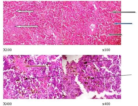 Photomicrographs Of A Splenic Section Of The Infected Untreated Rats