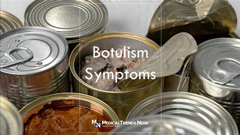 Botulism Symptoms A Silent Killer Medical Trends Now