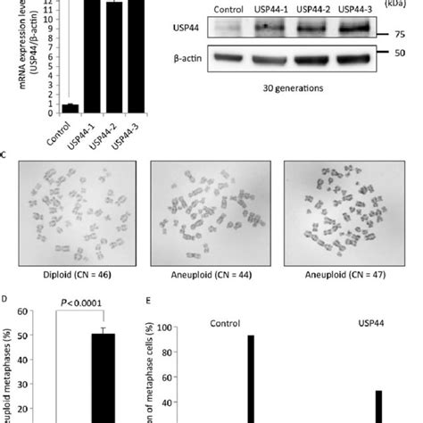 Immunohistochemistry Of Usp44 Expression In Human Gastric Cancer