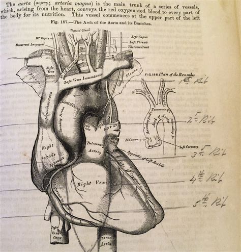 Under Your Skin The Anatomy Artwork Of H V Carter Dittrick Medical