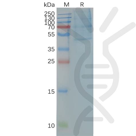 Human Ccr Full Length Protein Synthetic Nanodisc Dima Biotechnology