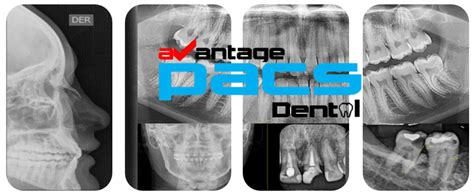 Avantage Pacs Dental Avantage Health System