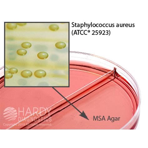 Hardy Diagnostic J115 Dry Culture Media Msamsa Biplate Biplate 90