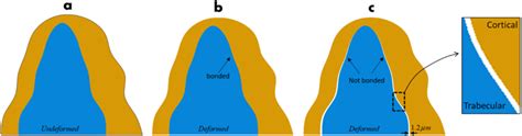 A Undeformed And B C Deformed Configurations Of The Anterior Download Scientific Diagram