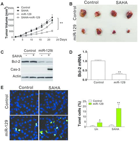 LncRNA NEAT1 MiR 129 Bcl 2 Signaling Axis Contributes To HDAC Inhibitor