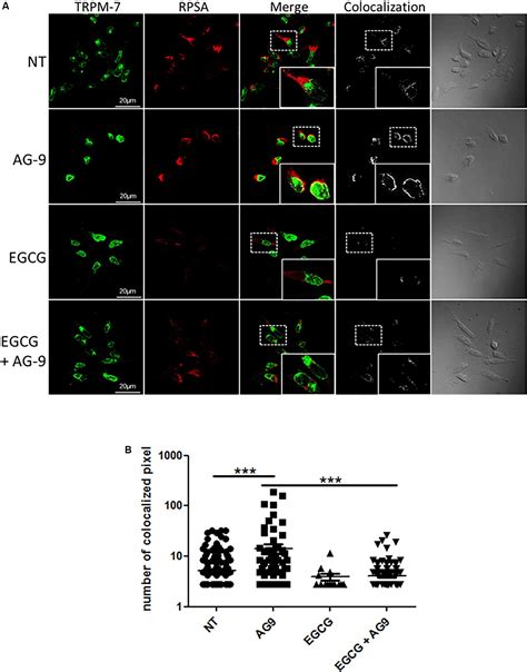 Frontiers Trpm Rpsa Complex Regulates Pancreatic Cancer Cell Migration