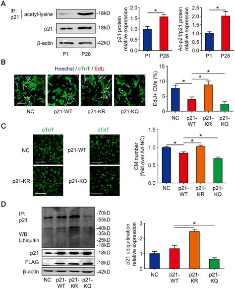 Sirt1-inducible deacetylation of p21 promotes cardiomyocyte ...
