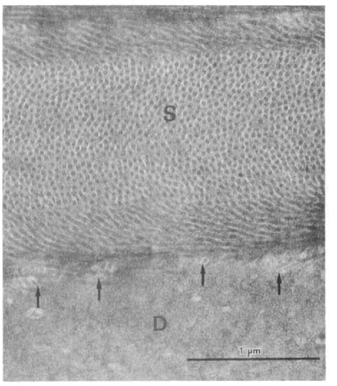 Figure 4 From The Three Dimensional Organization Of Collagen Fibrils In