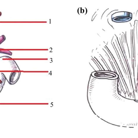 Anatomical Representation Of Ligament Of Treitz And Superior Mesentery