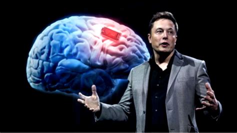 Transhumanismo Elon Musk Propone “neuralink” Implante Craneano Con Ia Para “arreglar Lo Que