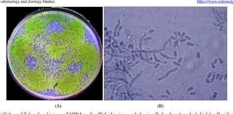 Figure 4 from Entomopathogenic microbes naturally infecting whitefly, Bemisia tabaci (Genn ...