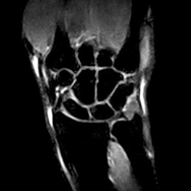 Risonanza Magnetica Articolare E MOC DEXA