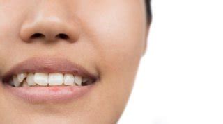 Comment calmer un mal de dents sans médicaments