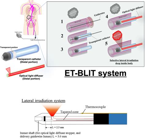 Inside The Body Light Delivery System Using Endovascular Therapy Based