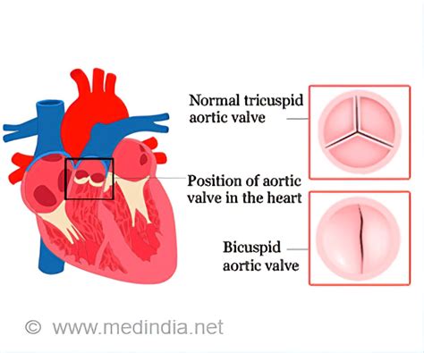 Bav Cardiology Informacionpublica Svet Gob Gt