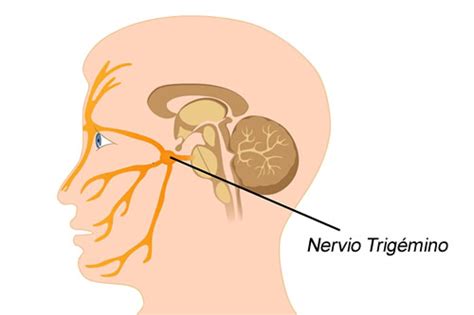 Neuralgia Del Trigémino Síntomas Y Tratamiento En Guayaquil Fisiopro