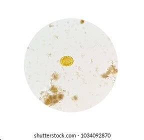 Stool Parasites Examination Test Parasites Eggs Stock Photo 1032664225 ...