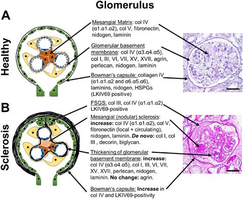 Glomerular Basement Membrane Histology