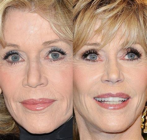 Jane Fonda Eyelid Surgery Jane Fonda Plastic Surgery Jane Fonda