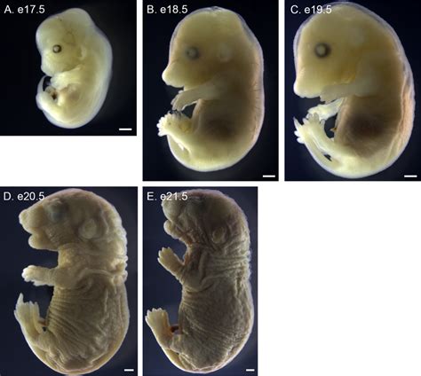 Lateral Views Of P Maniculatus Embryos From E To E A E