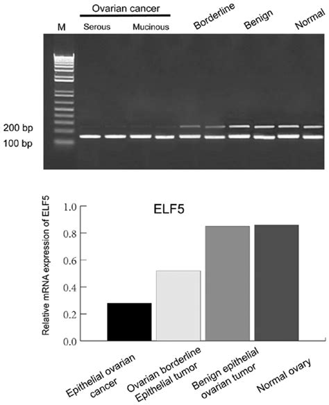 Mrna Expression Of Elf5 In Different Ovarian Tissues Elf5 E74 Like Download Scientific