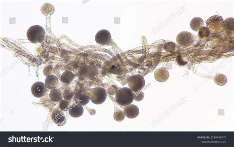 Rhizopus Oryzae Filamentous Heterothallic Microfungus Fresh Stockfoto