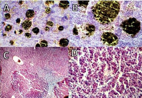 A Photomicrograph Of Black Scorpionfish Splenic Tissue Showing Severe