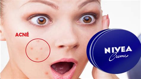 La Verdad De Nivea Creme Por Qu Te Saca Acn Youtube