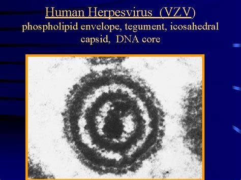 Common Features Of Herpesviruses Morphology Basic Mode Of