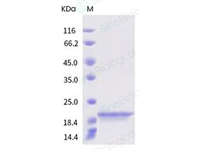 Recombinant Human BAFF BLyS TNFSF13B Protein 10056 HNCH Sino Biological