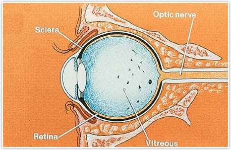 Eye Floaters Specialist Detroit / Rochester - Dr. Mark Weingarten