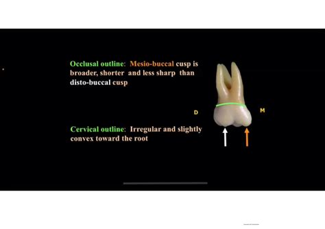 Solution Maxillary First Molar Studypool