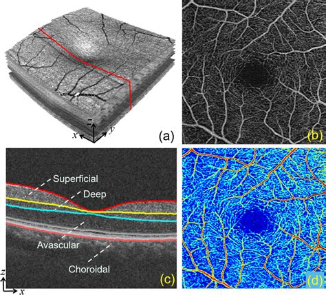 Visualization Of A A Sample 3D OCTA Volume B 2D En Face Angiogram