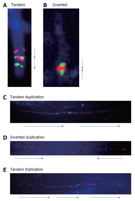 Fiber Fluorescence In Situ Hybridization Analyses As A Diagnostic