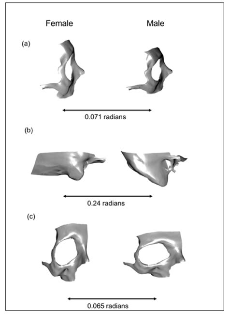 Applying A Geometric Morphometric Surface Semilandmark Based Approach