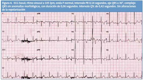 Casos clínicos en Cardiología n º 13 diagnóstico diferencial de la